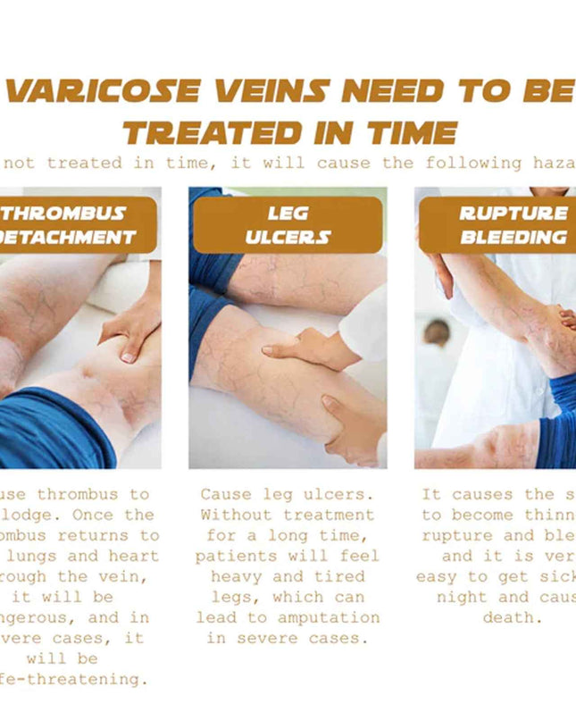 Ximonth Vein Renewal Smooth Legs Cream, Relief Sore Legs Massage Varicose Earthworm Leg Vein Care Cream