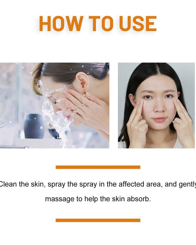 Ximonth Bee Venom Wart & Hidradenitis Suppurativa Treatment Spray, Skin Cleansing Repair Fade Moles Corns Body Care Spray