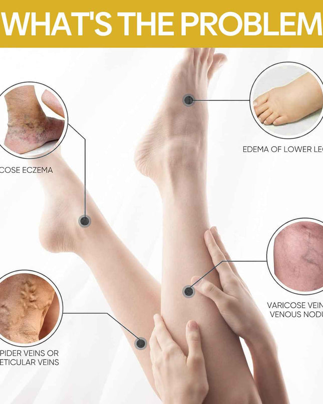 Ximonth Bee Venom Leg Care Cream Relieves Leg Discomfort, Pamper And Moisturize Skin Body Care Cream