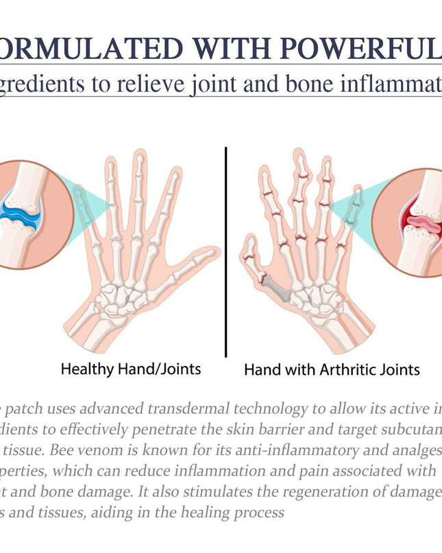 Ximonth Bee Venom Joint Cream, Relieves Hands Legs Bones Knees Lumbar Spine Sedentary Joint Pain Body Care Cream