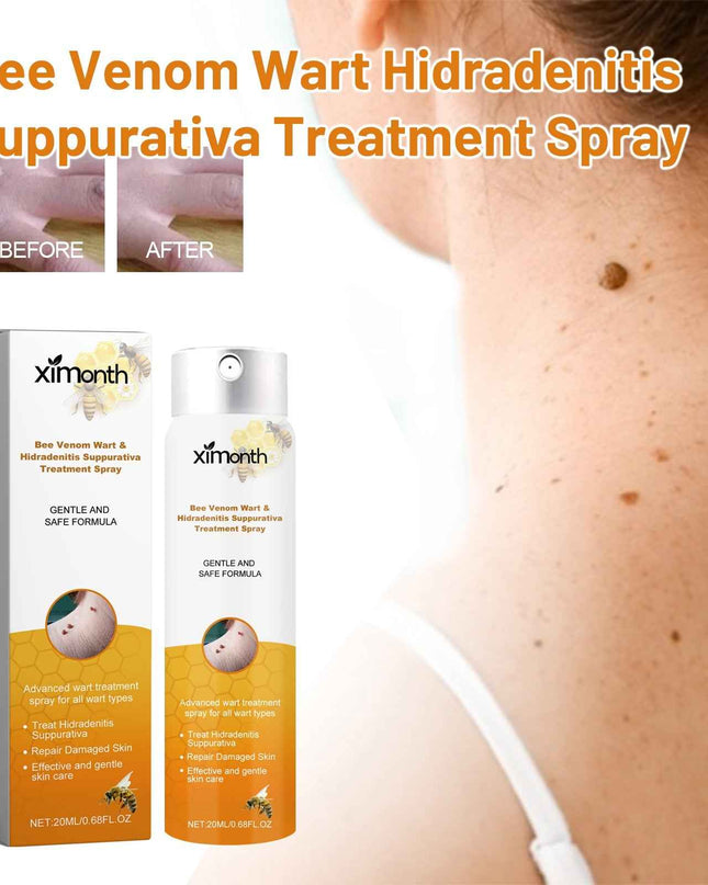 Ximonth Bee Venom Wart & Hidradenitis Suppurativa Treatment Spray, Skin Cleansing Repair Fade Moles Corns Body Care Spray